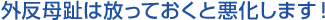 外反母趾は放っておくと悪化します!